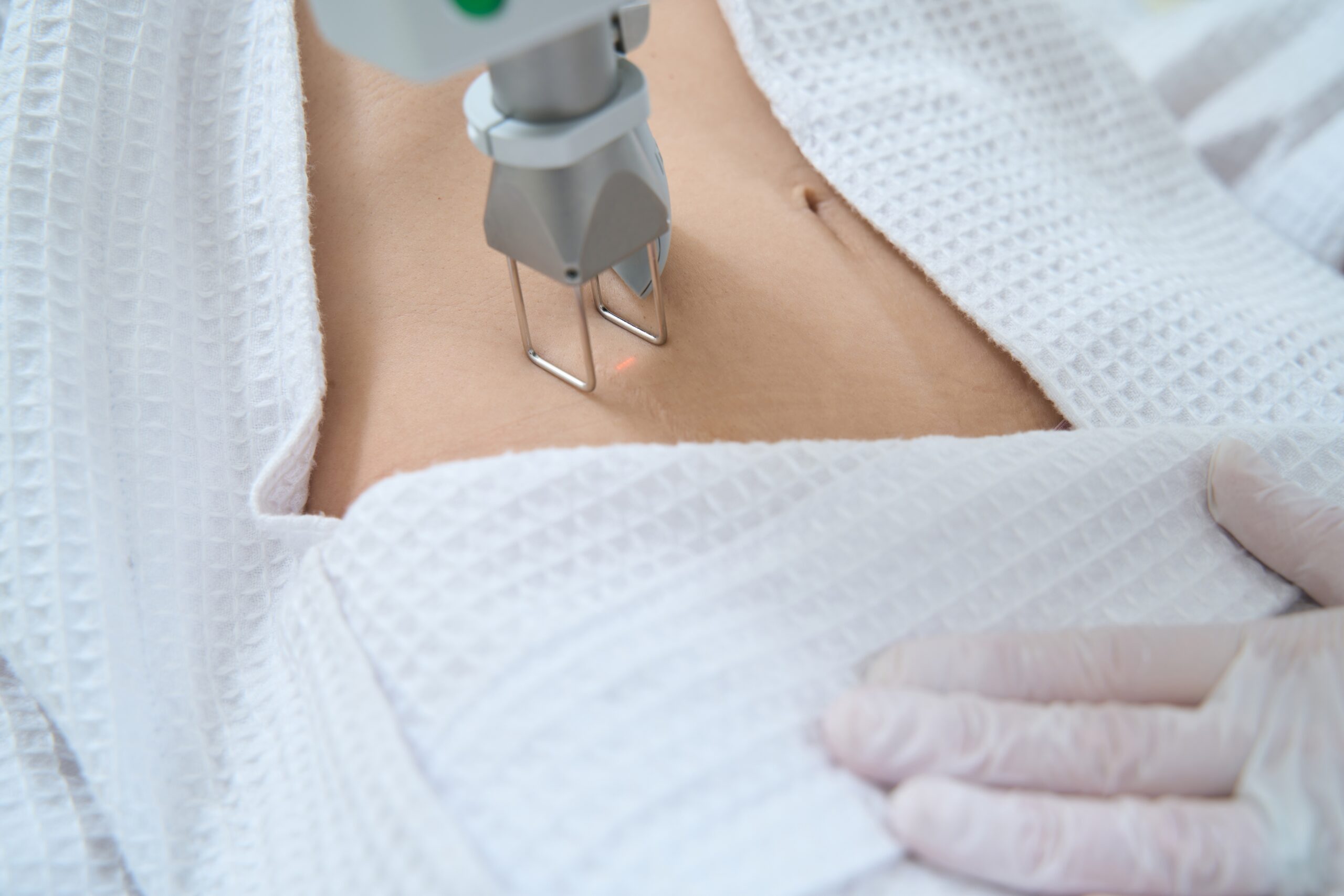 Dermatologic Laser Surgery